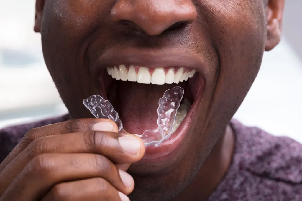 man wearing mouth guard