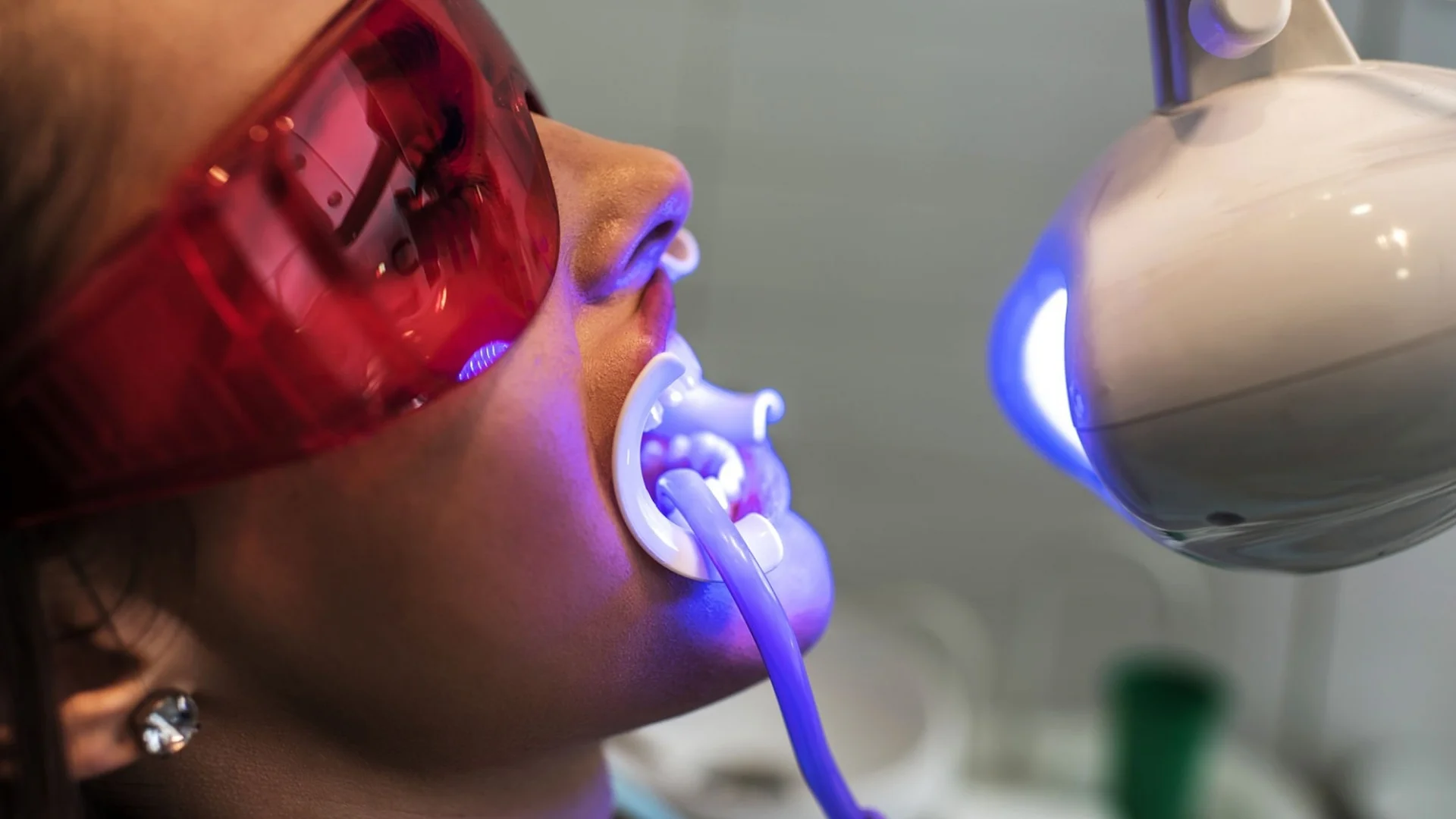 Woman whitening her teeth